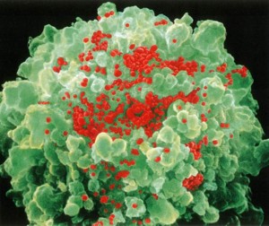 File:Linfocita.jpg